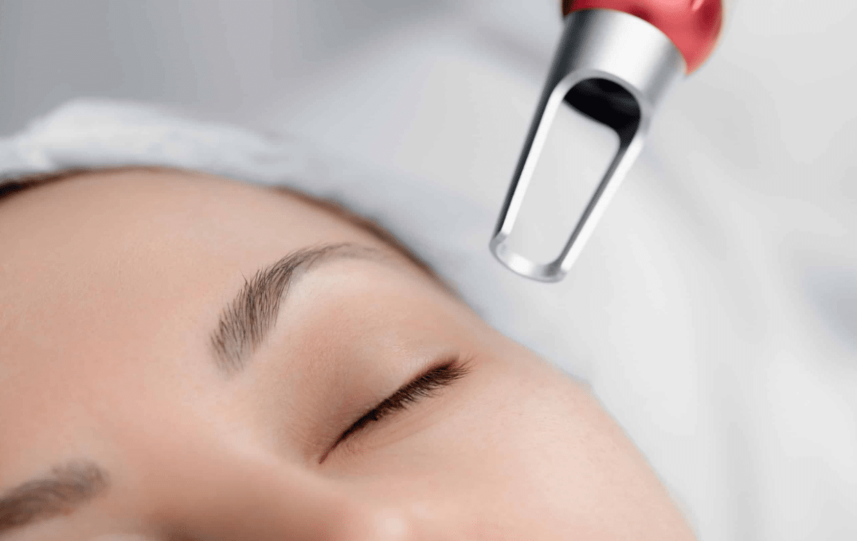 Laser smooths rough skin.