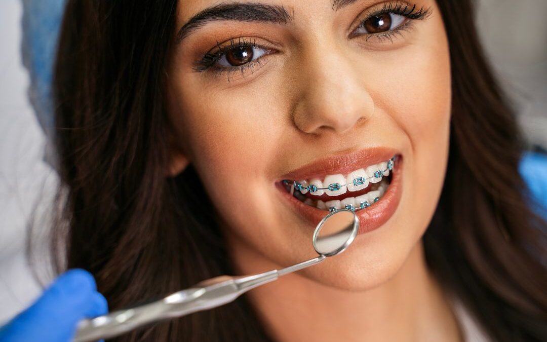 How to Care for Your Metal Braces: Tips for a Healthy Smile