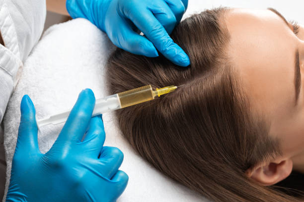 PRP Hair Treatment in Dubai: Restore Thinning Hair