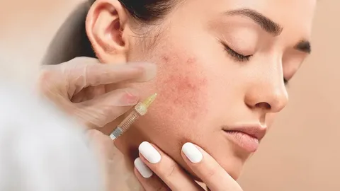 Pimples Treatment in Dubai for Sensitive and Acne-Prone Skin