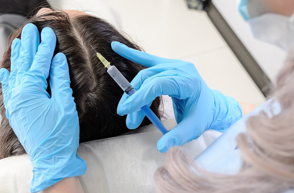 Restore Hair Thickness with Hair Fillers