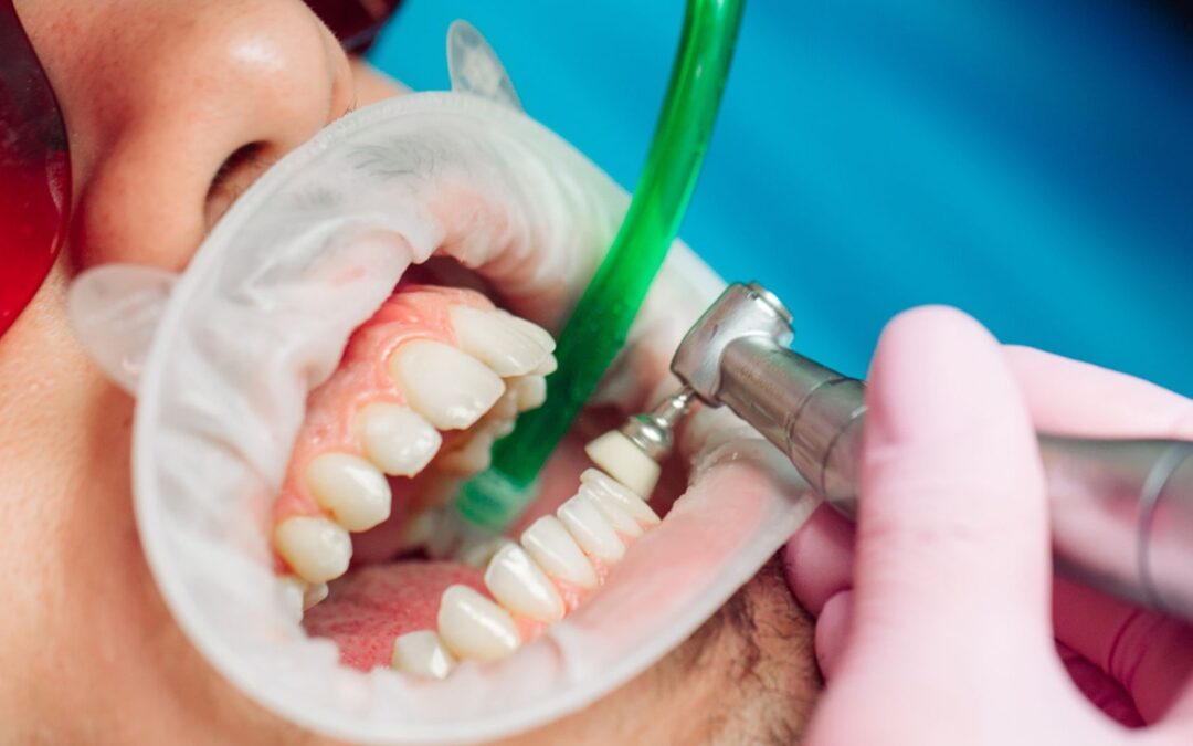 Teeth Cleaning During Pregnancy: What Moms-to-Be Should Know