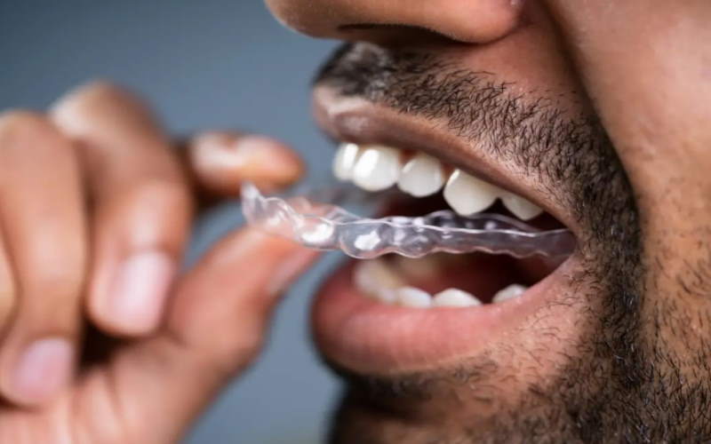 Teeth Grinding Treatment