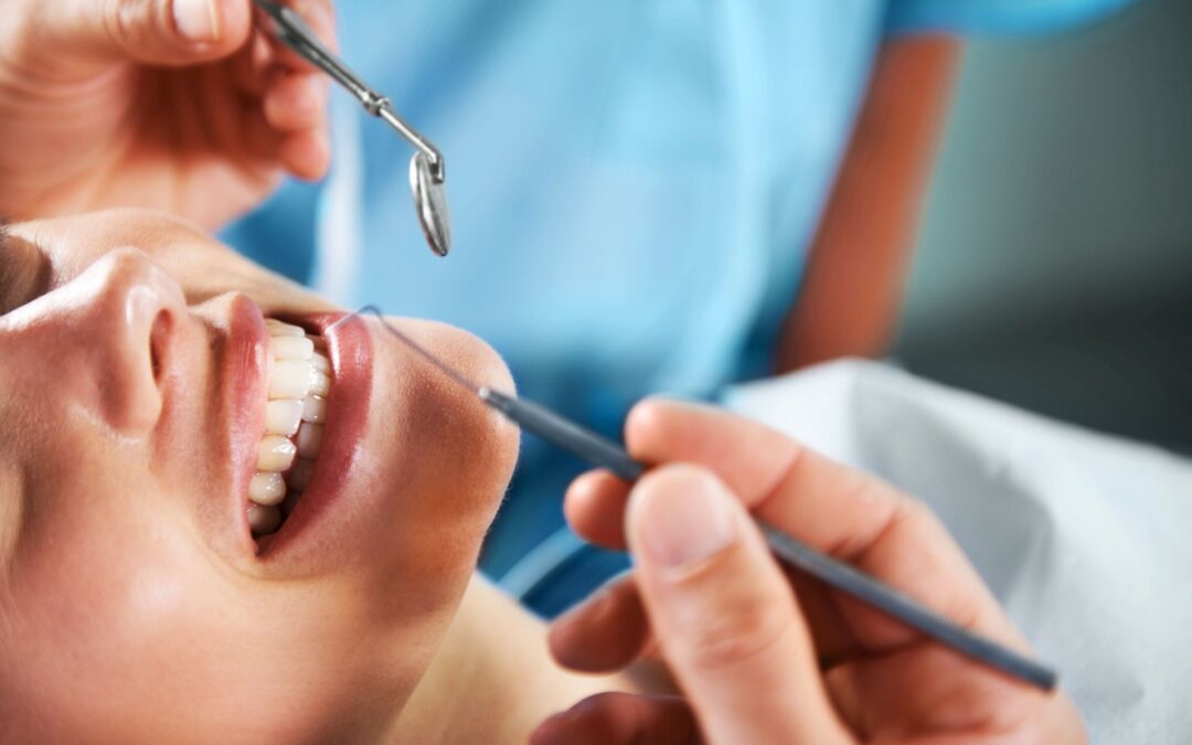 Top Benefits of Teeth Polishing and Scaling You Didn’t Know About