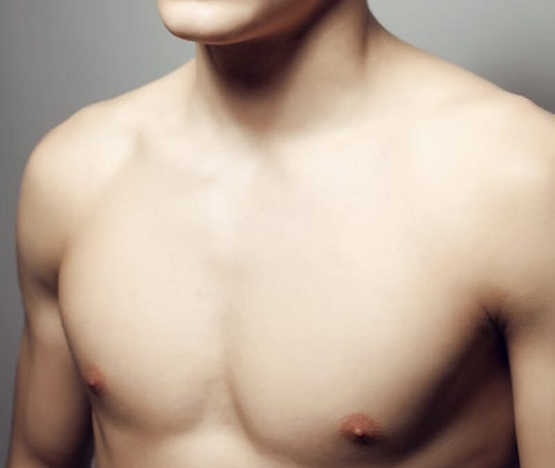What to Expect After Gynecomastia Surgery: Recovery and Results Timeline