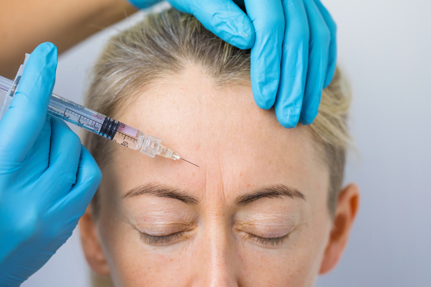 Why Botox Is More Than Just a Beauty Treatment Why Botox Is More Than Just a Beauty Treatment