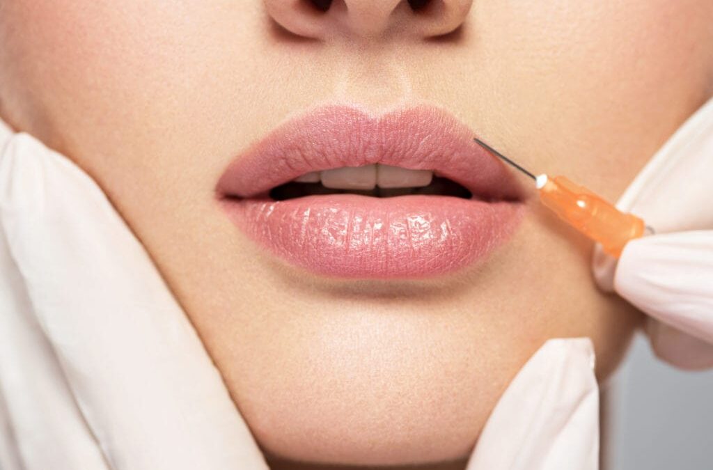 Why Women Love Russian Lip Fillers