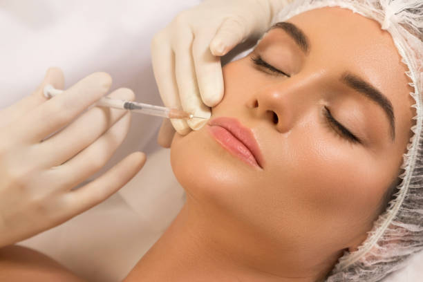 Why Women Love Russian Lip Fillers for Subtle Volume ?
