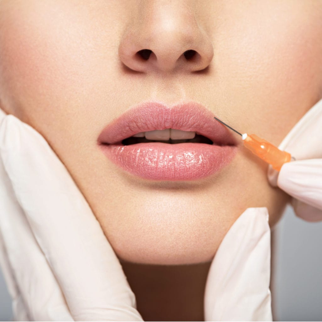 Why Women Love Russian Lip Fillers