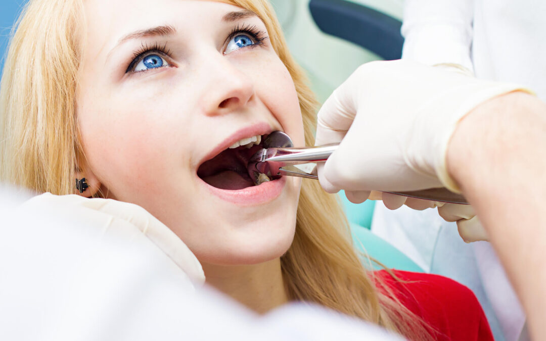 Wisdom Tooth Extraction in Teens vs Adults: Differences You Should Know