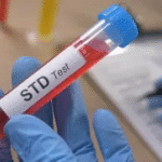 STD Test in Dubai
