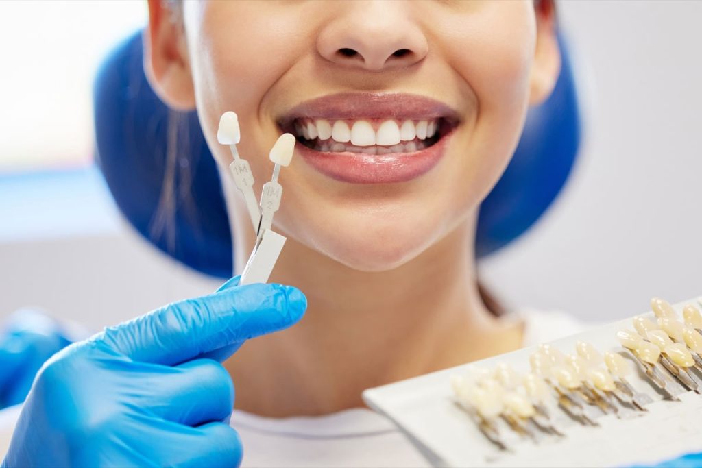 Affordable composite veneers Dubai