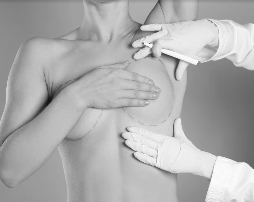 Breast Reduction Surgery in Dubai – Safe & Effective