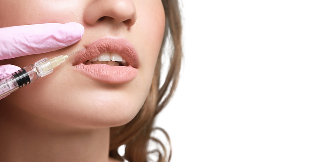 Lip Augmentation tailored to your facial feautres