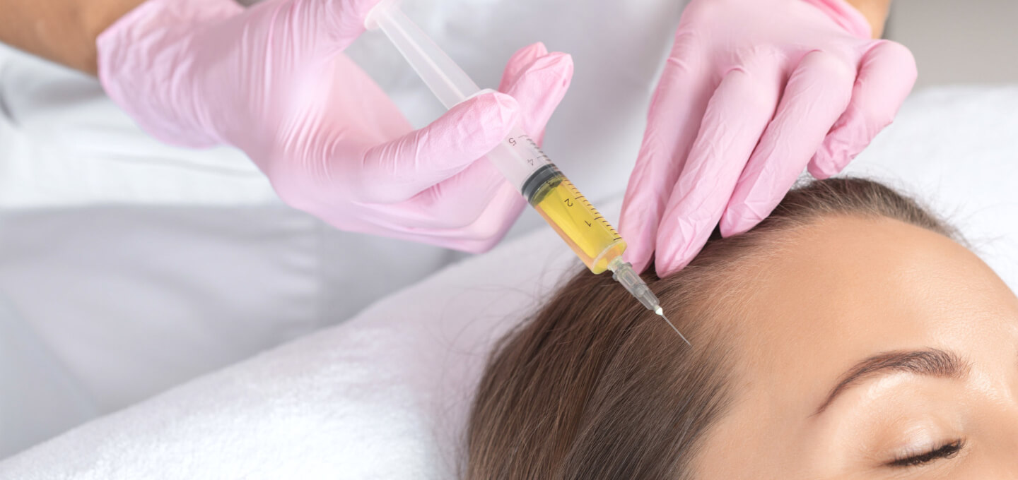 Non-Invasive Hair Restoration with Fillers