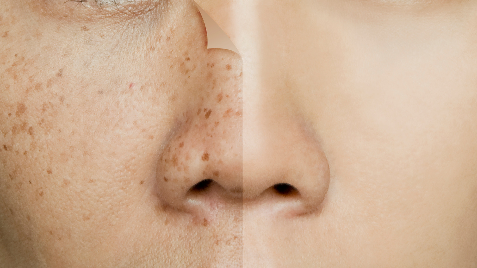 Dermal Pigmentation in Riyadh