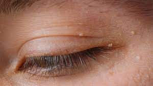 Soft skin solution Soft skin solution