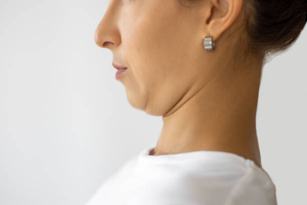 What Happens During Double Chin Removal Surgery?