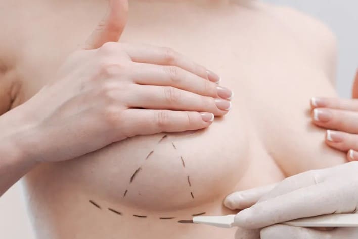 Who Benefits Most from Short Scar Breast Augmentation ?
