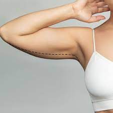 Sculpt and Tone with an Arm Lift in Jeddah