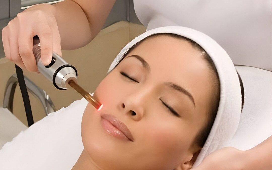 Professional Skin Care with Chemical Peel in Islamabad