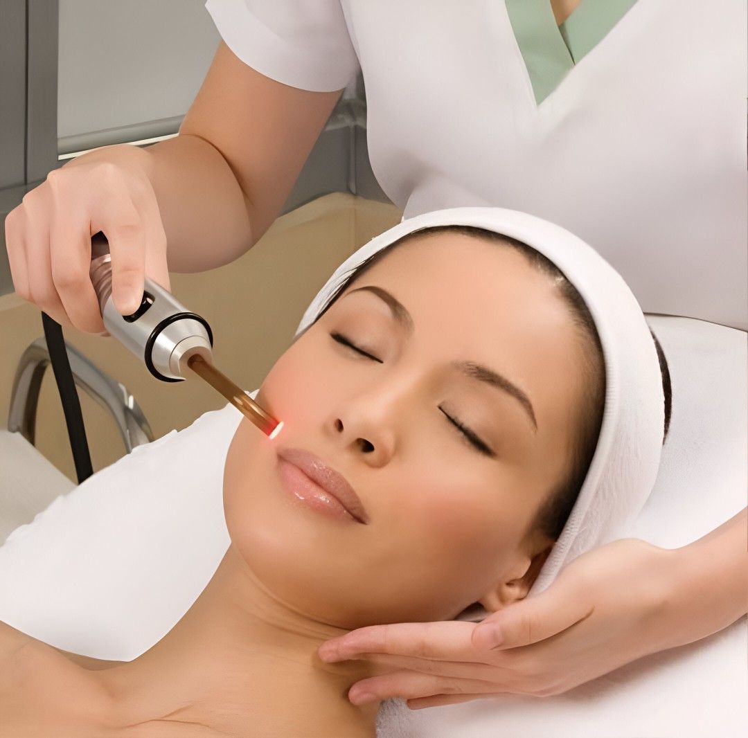 chemicalpeeltreatmentinIslamabad