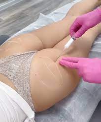 كل ما يجب معرفته عن الفرق بين حقن السكلبترا وحقن الراديس في الرياض