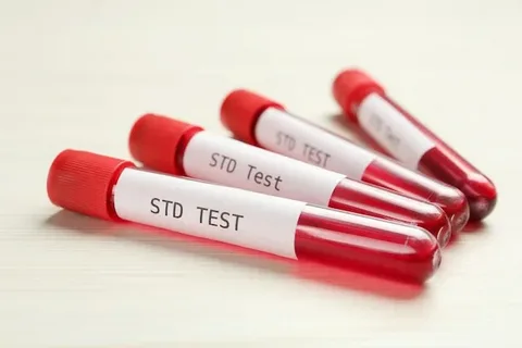 std test STD Testing in Dubai